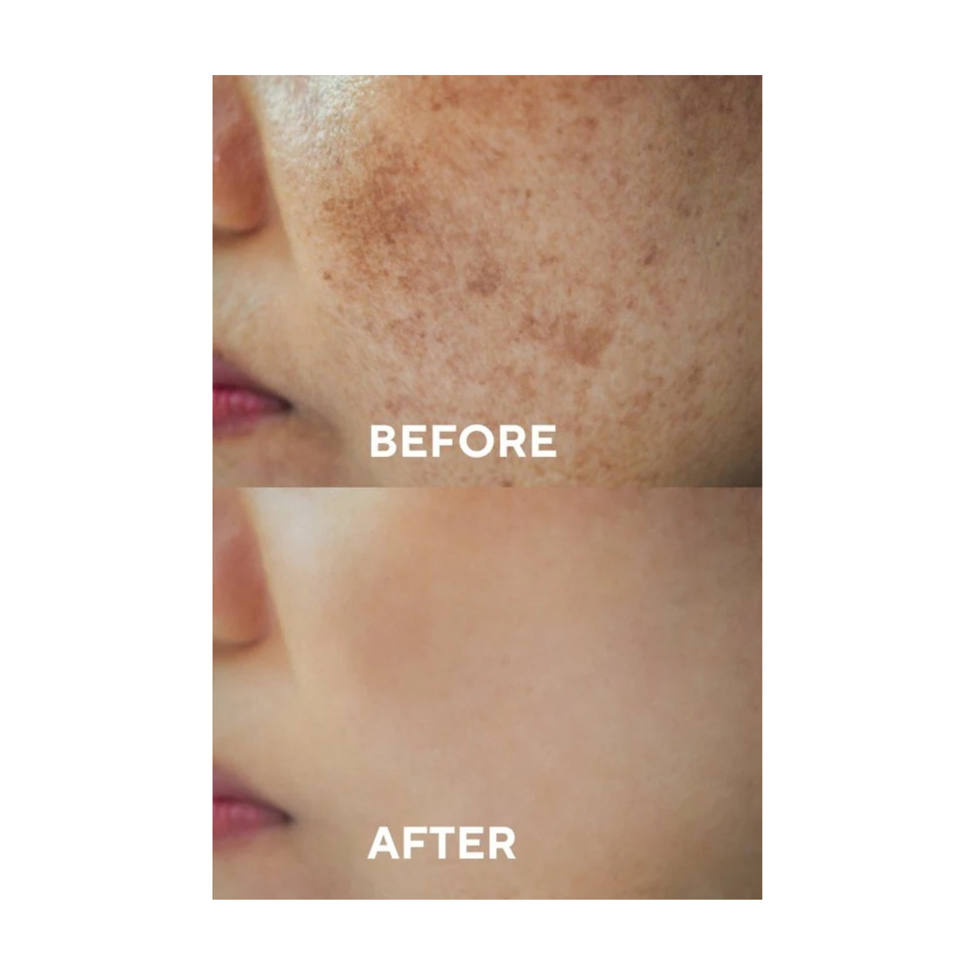 Ceel Natural Dark Spot Corrector Serum-30ml - Dark Spots & Pigmentation With Glutathione Alpha Arbutin 2%, HyaluronicAcid and Niacinamide