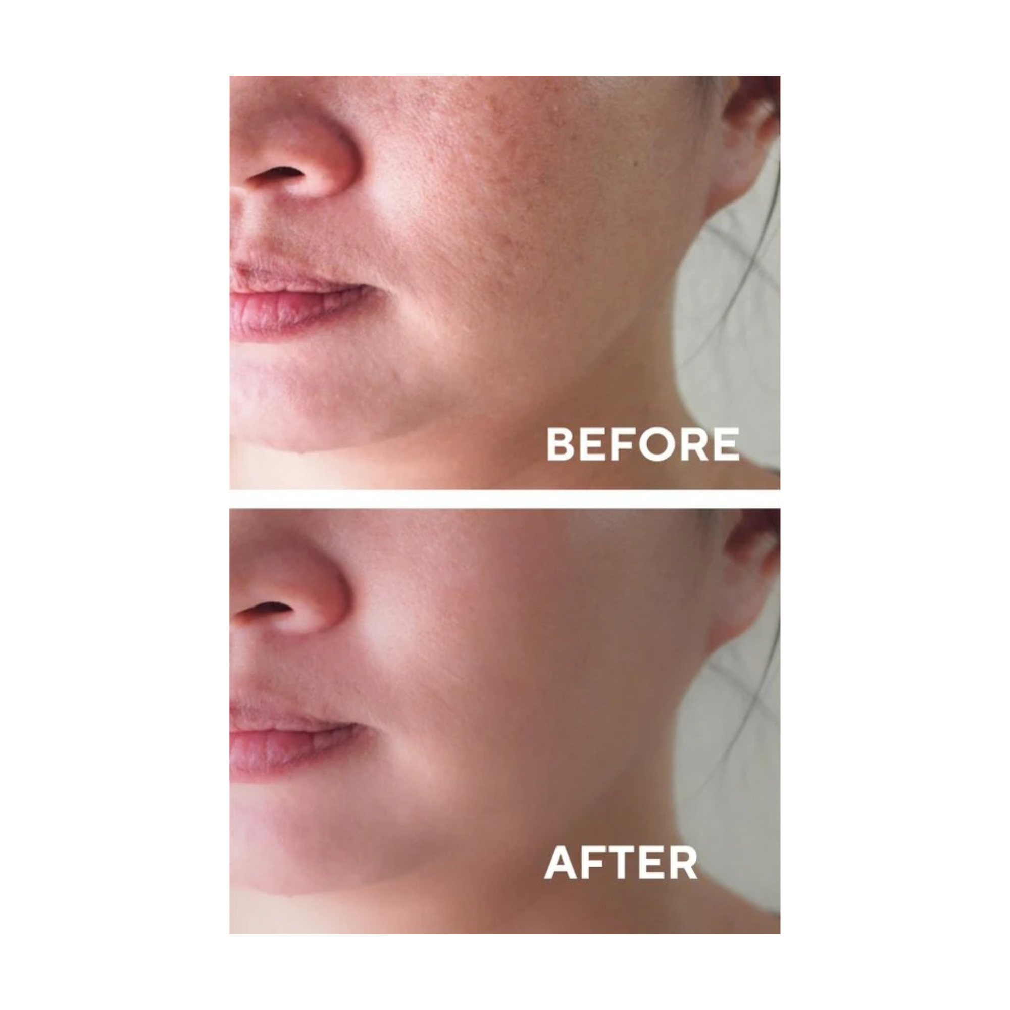 Ceel Natural AHA+BHA Red Peeling Serum-30ml - Skin Dullness