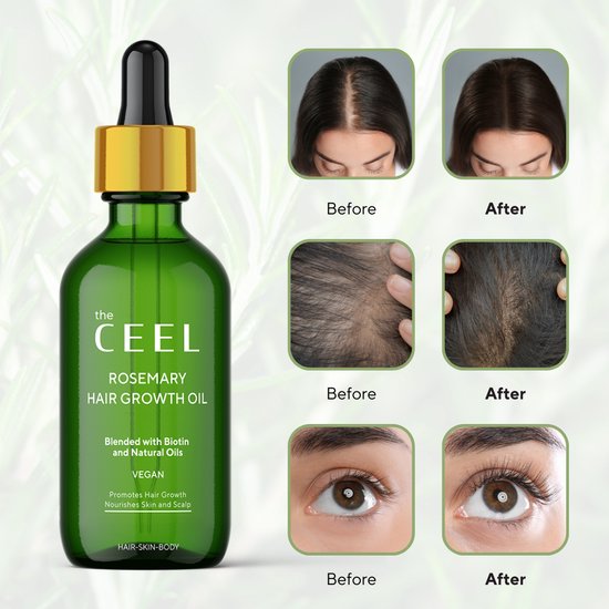 Ceel Rosemary Hair Oil-50ml – Scalp and Hair Nourishment with Derma Roller 0.5mm