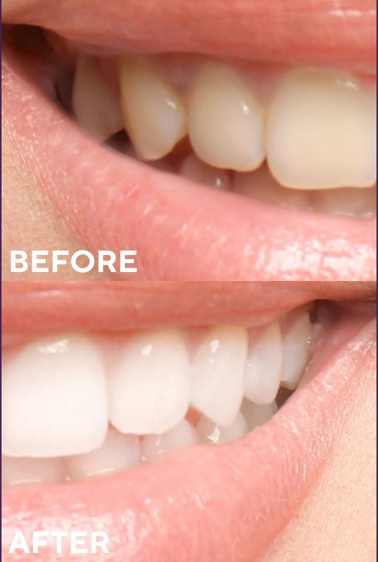 Ceel Whitening Ritual – Purple Carbon Combo ( Toothpaste 75g + Powder 50g )